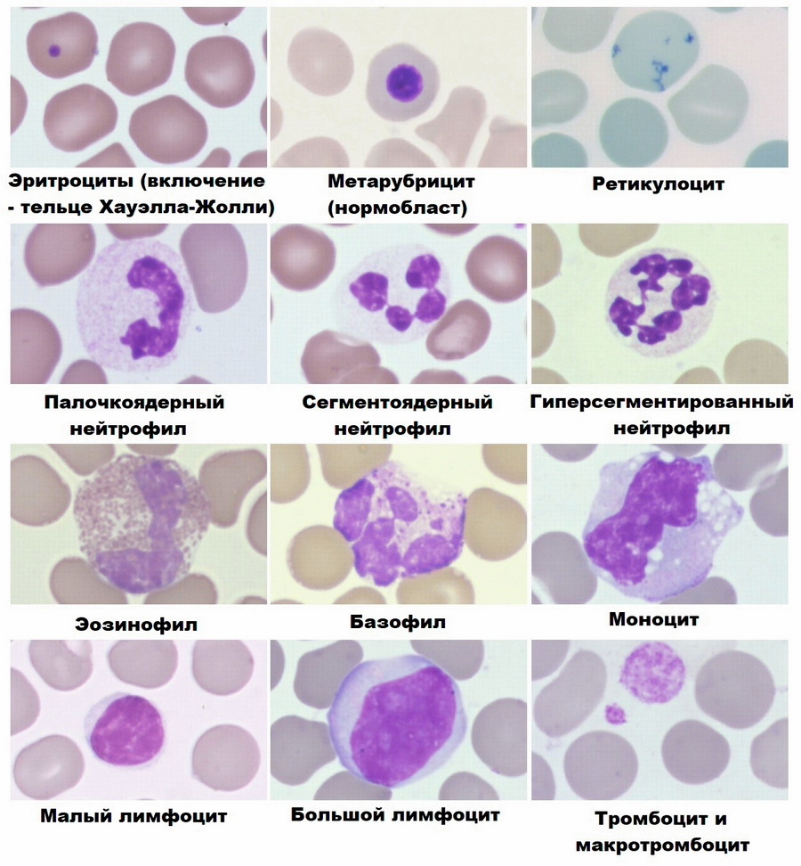 white whale blood cells x900
